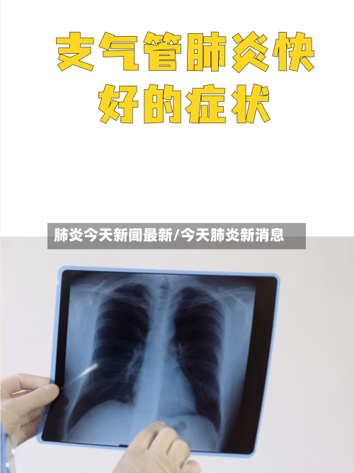肺炎今天新闻最新/今天肺炎新消息-第2张图片